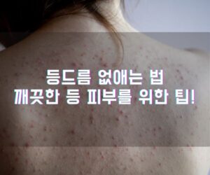 등드름 없애는 법 깨끗한 등 피부를 위한 팁