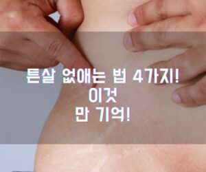 튼살 없애는 법 4가지! 이것만 기억!