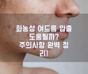 화농성 여드름 압출, 도움될까 주의사항 완벽 정리!