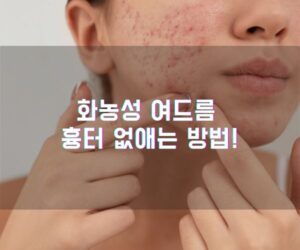 화농성 여드름 흉터 없애는 방법!