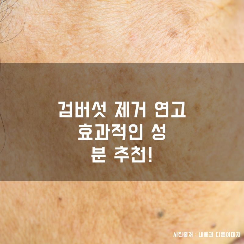 검버섯 없애는 법, 검버섯 크림 정말 효과 있을까 (1)