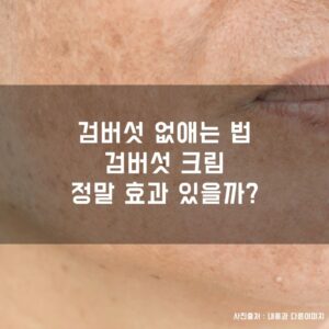 검버섯 없애는 법, 검버섯 크림 정말 효과 있을까