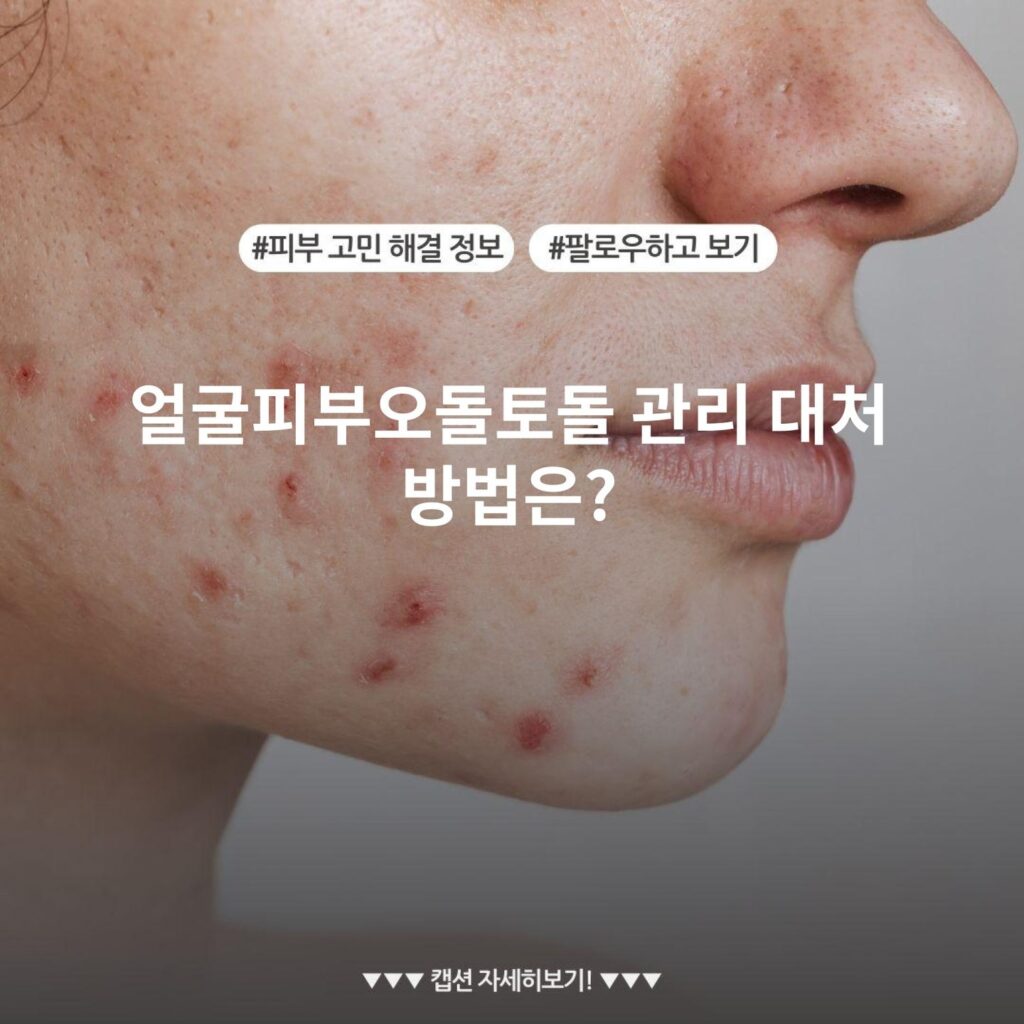 얼굴피부오돌토돌 관리 대처 방법은?