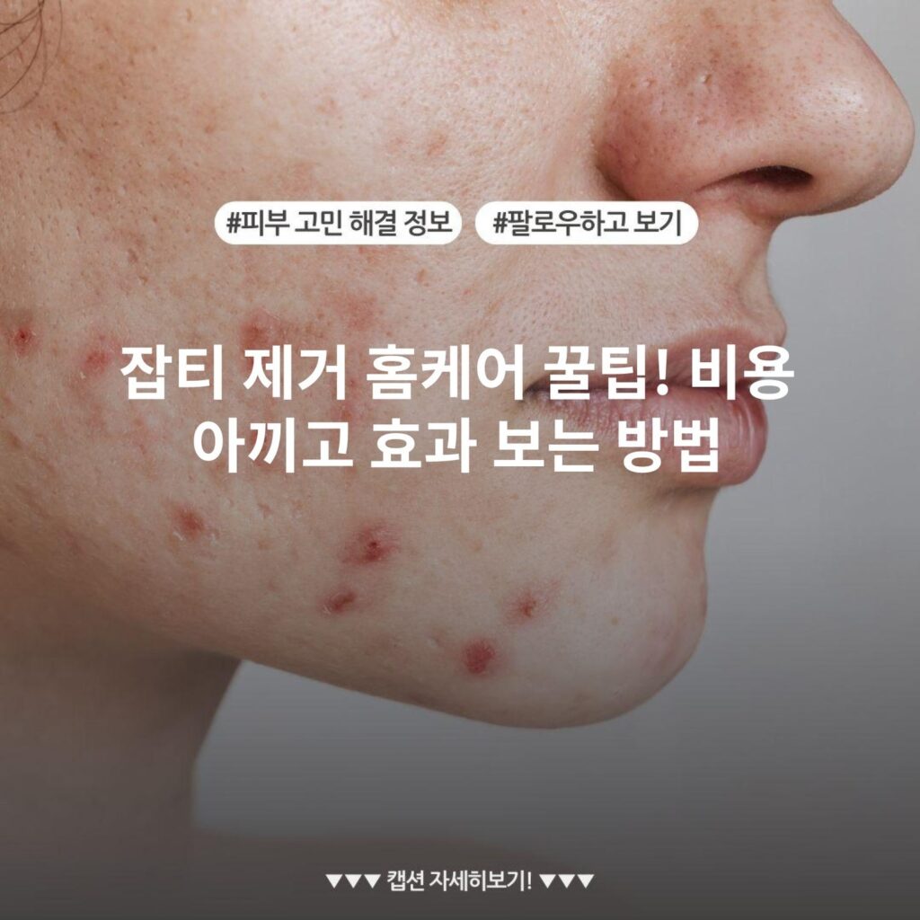 잡티 제거 홈케어 꿀팁! 비용 아끼고 효과 보는 방법