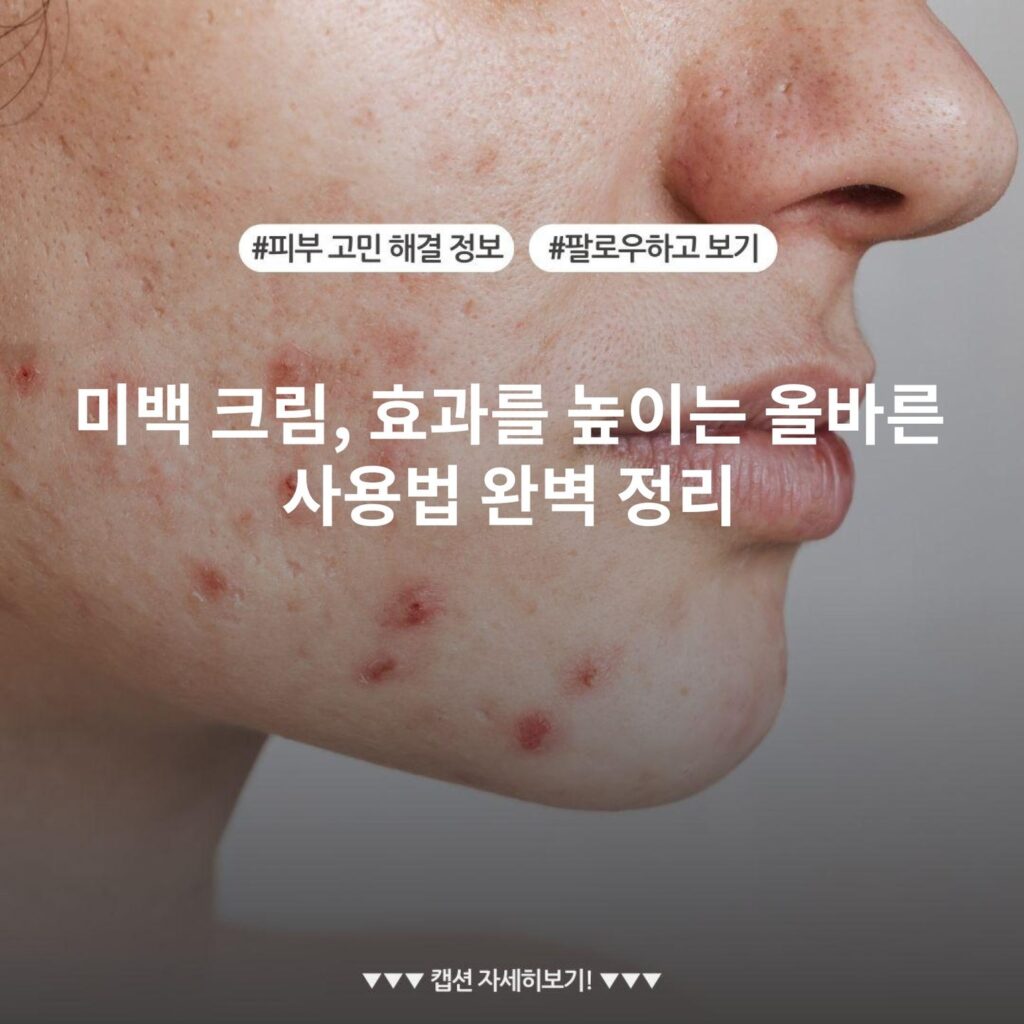 미백 크림, 효과를 높이는 올바른 사용법 완벽 정리