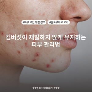 검버섯이 재발하지 않게 유지하는 피부 관리법