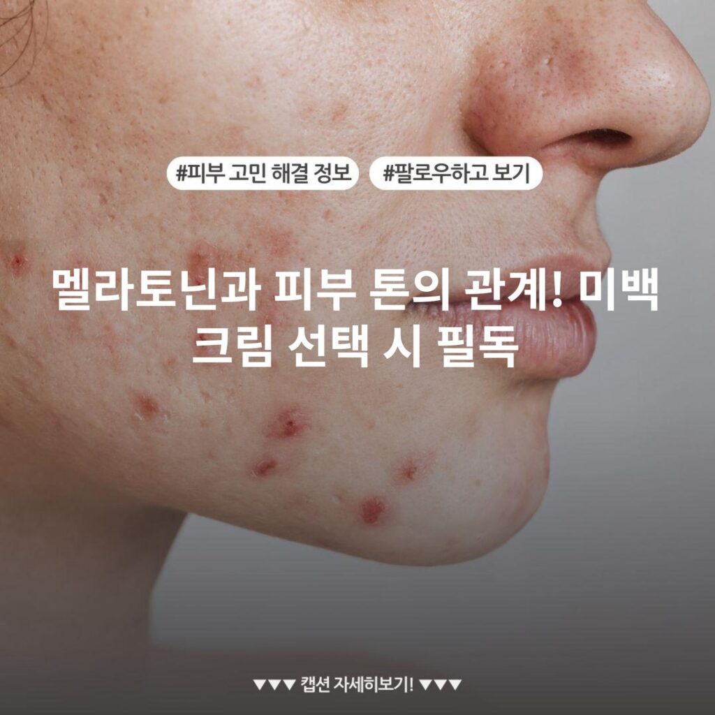 멜라토닌과 피부 톤의 관계! 미백 크림 선택 시 필독