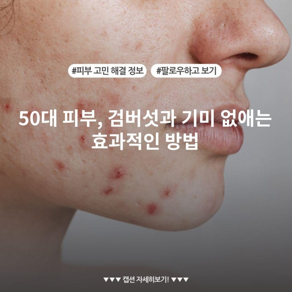 50대 피부, 검버섯과 기미 없애는 효과적인 방법