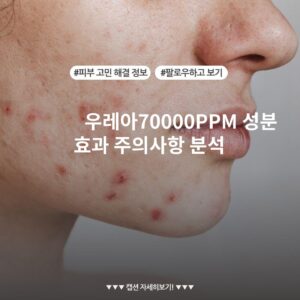 우레아70000PPM 성분 효과 주의사항 분석