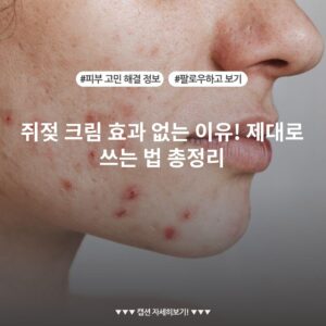 쥐젖 크림 효과 없는 이유! 제대로 쓰는 법 총정리