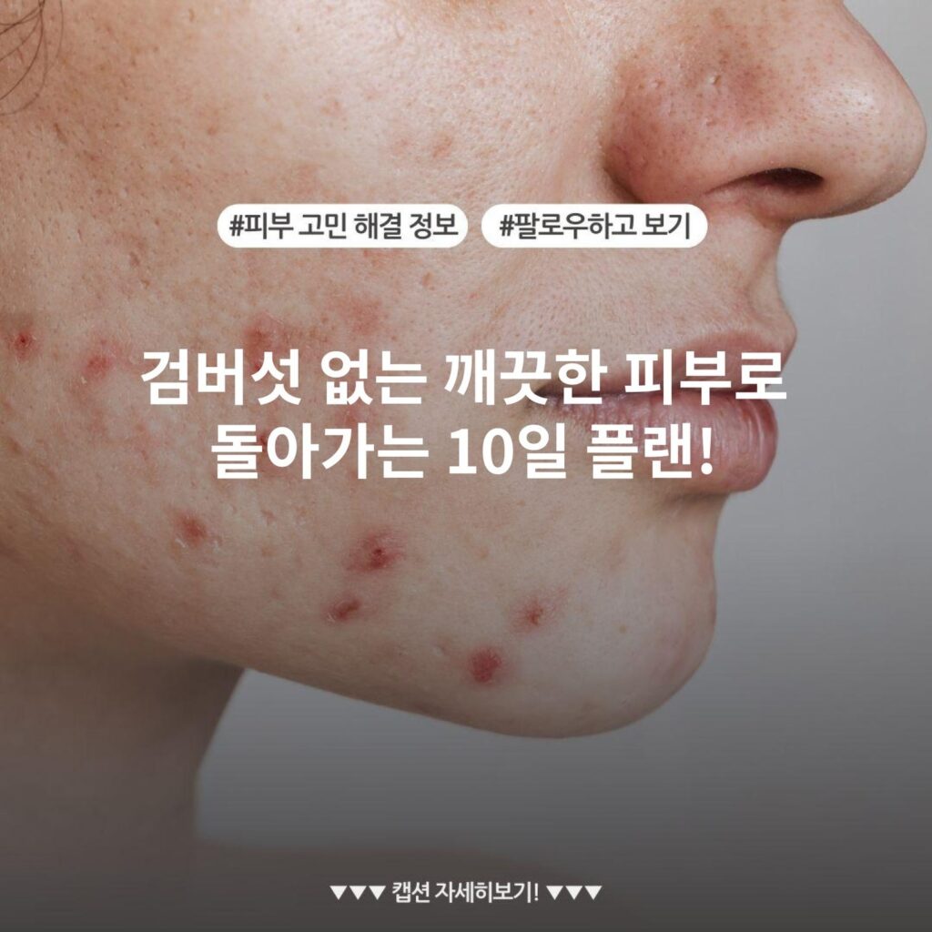 검버섯 없는 깨끗한 피부로 돌아가는 10일 플랜!