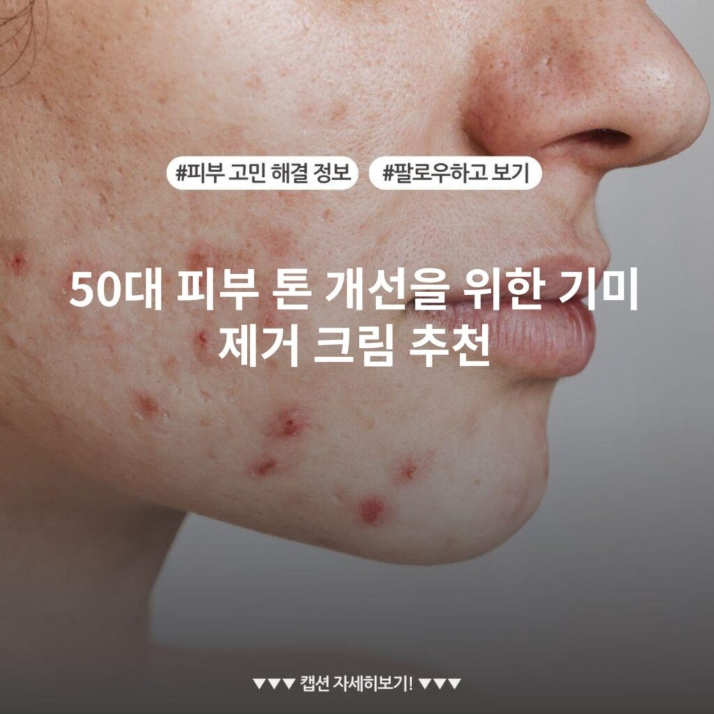 50대 피부 톤 개선을 위한 기미 제거 크림 추천