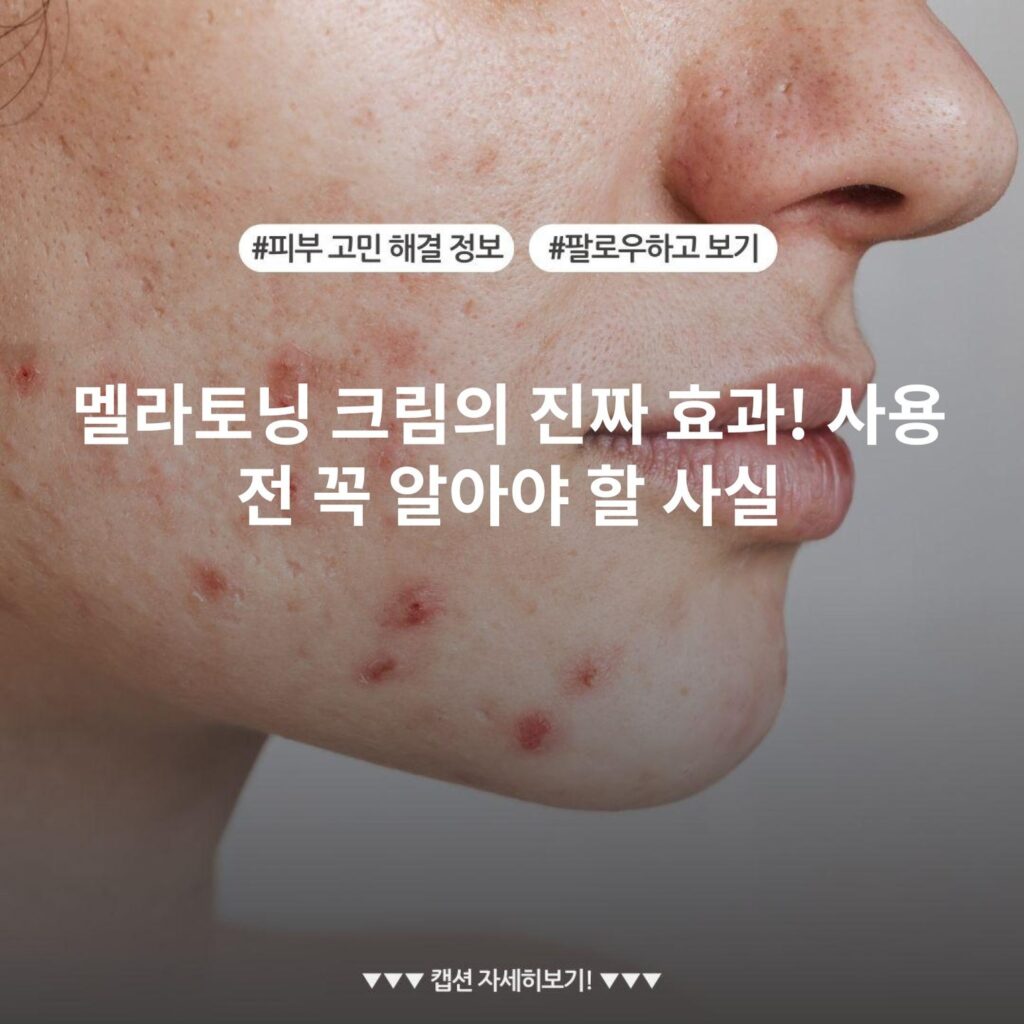 멜라토닝 크림의 진짜 효과! 사용 전 꼭 알아야 할 사실