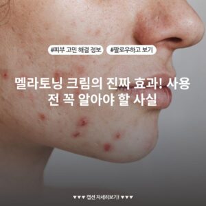 멜라토닝 크림의 진짜 효과! 사용 전 꼭 알아야 할 사실