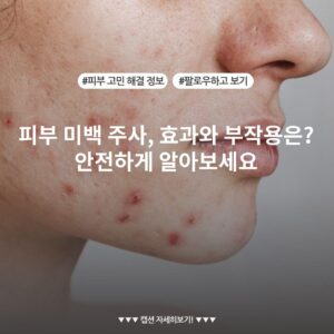 피부 미백 주사, 효과와 부작용은? 안전하게 알아보세요