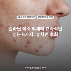 멜라닌 색소 억제에 효과적인 성분 6가지! 놓치면 후회