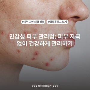 민감성 피부 관리법: 피부 자극 없이 건강하게 관리하기