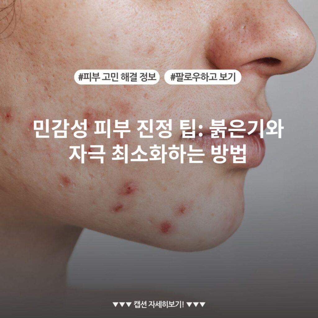 민감성 피부 진정 팁: 붉은기와 자극 최소화하는 방법