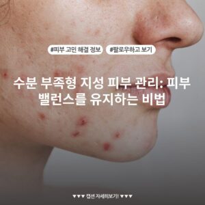 수분 부족형 지성 피부 관리: 피부 밸런스를 유지하는 비법