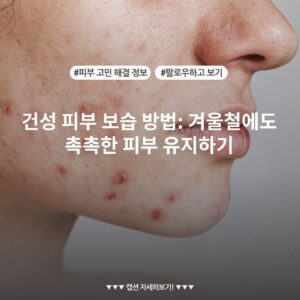 건성 피부 보습 방법: 겨울철에도 촉촉한 피부 유지하기