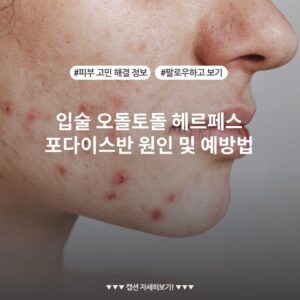 입술 오돌토돌 헤르페스 포다이스반 원인 및 예방법