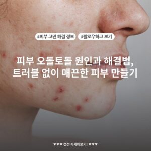 피부 오돌토돌 원인과 해결법, 트러블 없이 매끈한 피부 만들기