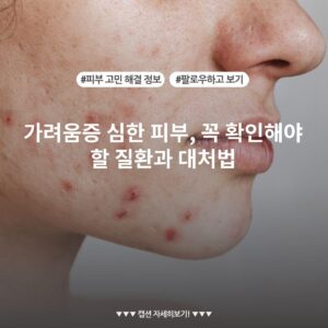 가려움증 심한 피부, 꼭 확인해야 할 질환과 대처법