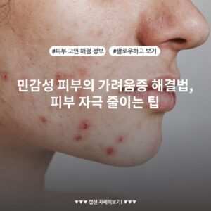 민감성 피부의 가려움증 해결법, 피부 자극 줄이는 팁