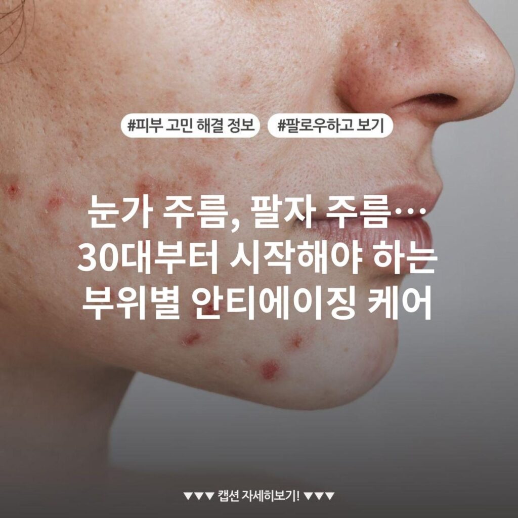 눈가 주름, 팔자 주름… 30대부터 시작해야 하는 부위별 안티에이징 케어
