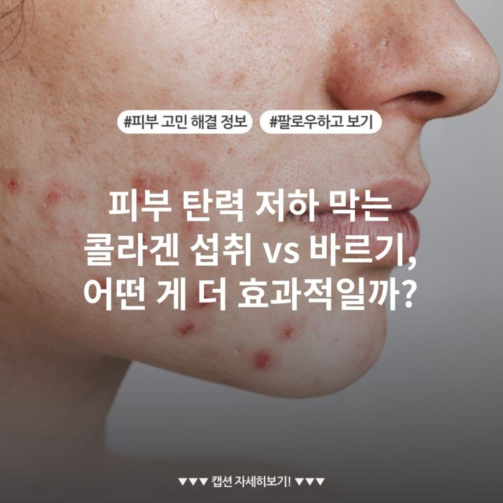 피부 탄력 저하 막는 콜라겐 섭취 vs 바르기, 어떤 게 더 효과적일까?