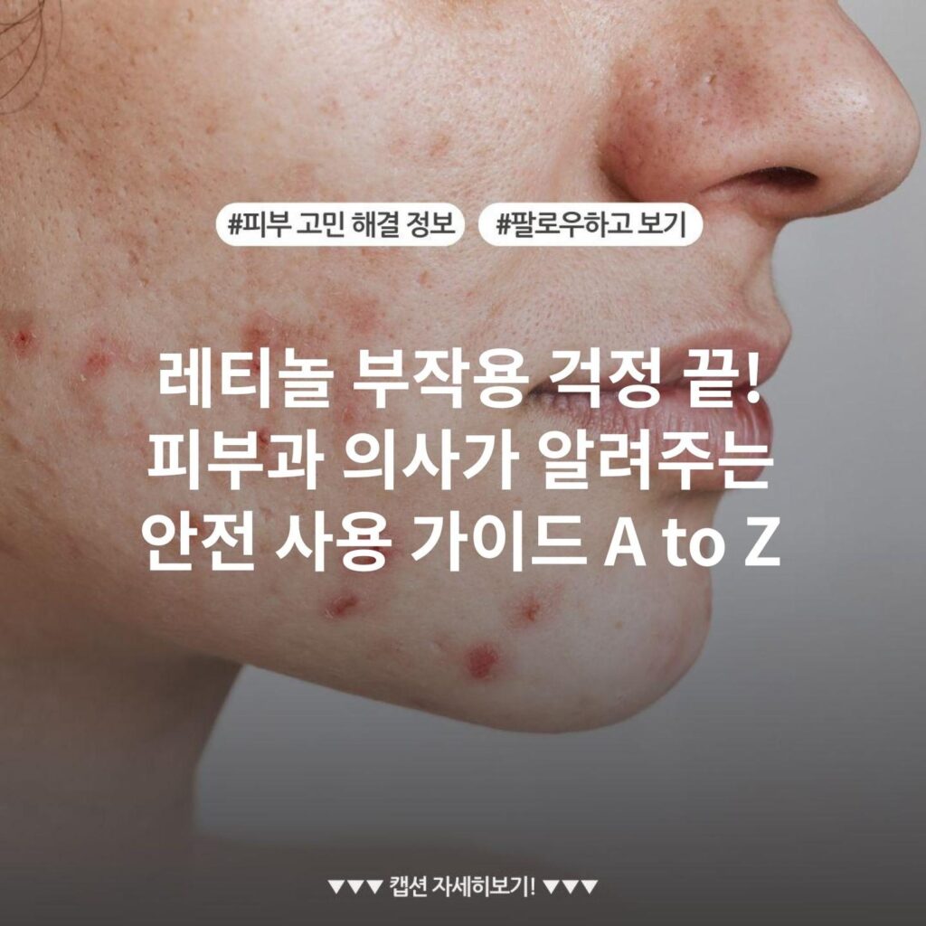 레티놀 부작용 걱정 끝! 피부과 의사가 알려주는 안전 사용 가이드 A to Z