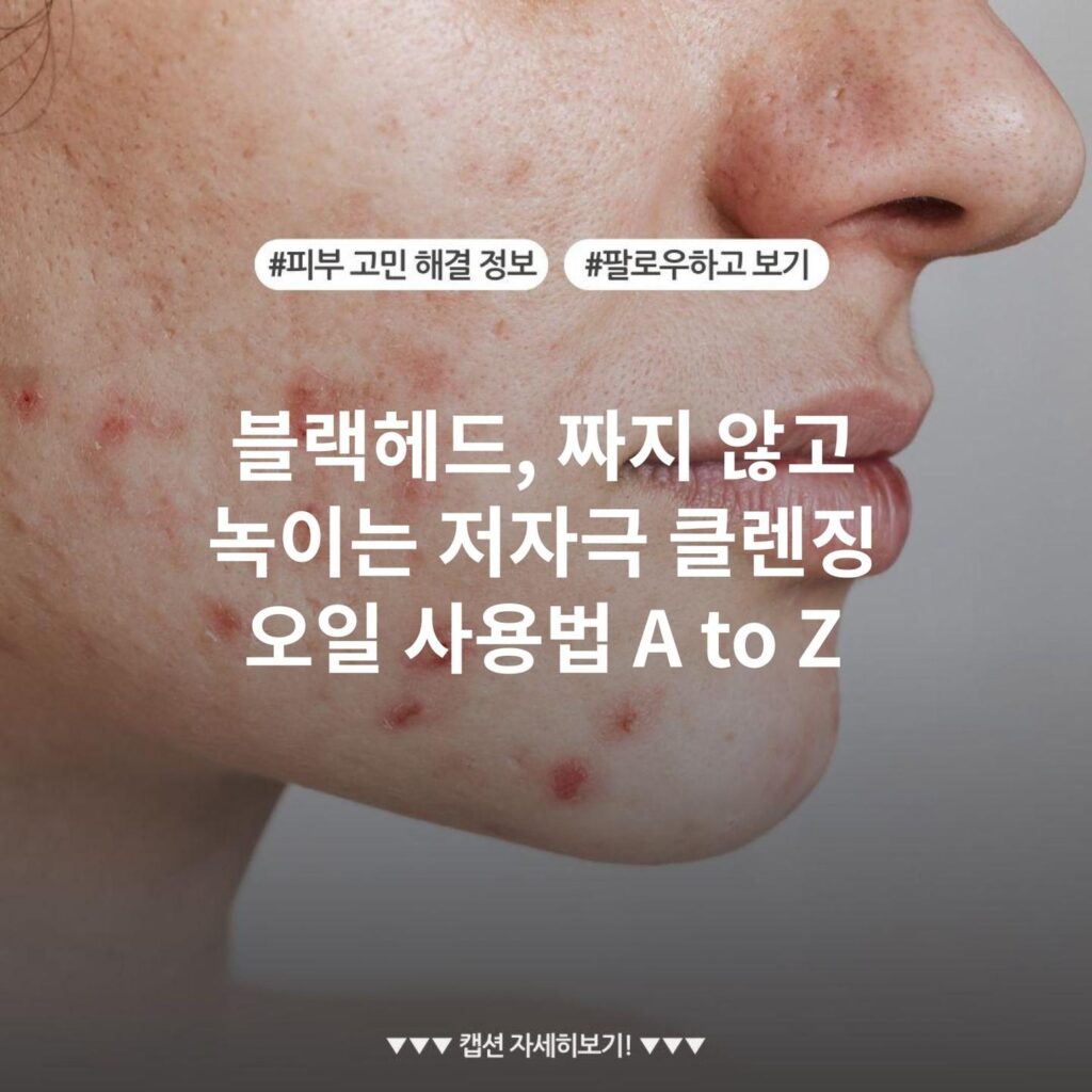 블랙헤드, 짜지 않고 녹이는 저자극 클렌징 오일 사용법 A to Z