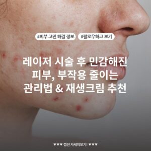 레이저 시술 후 민감해진 피부, 부작용 줄이는 관리법 & 재생크림 추천