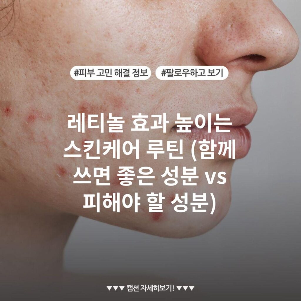 레티놀 효과 높이는 스킨케어 루틴 (함께 쓰면 좋은 성분 vs 피해야 할 성분)