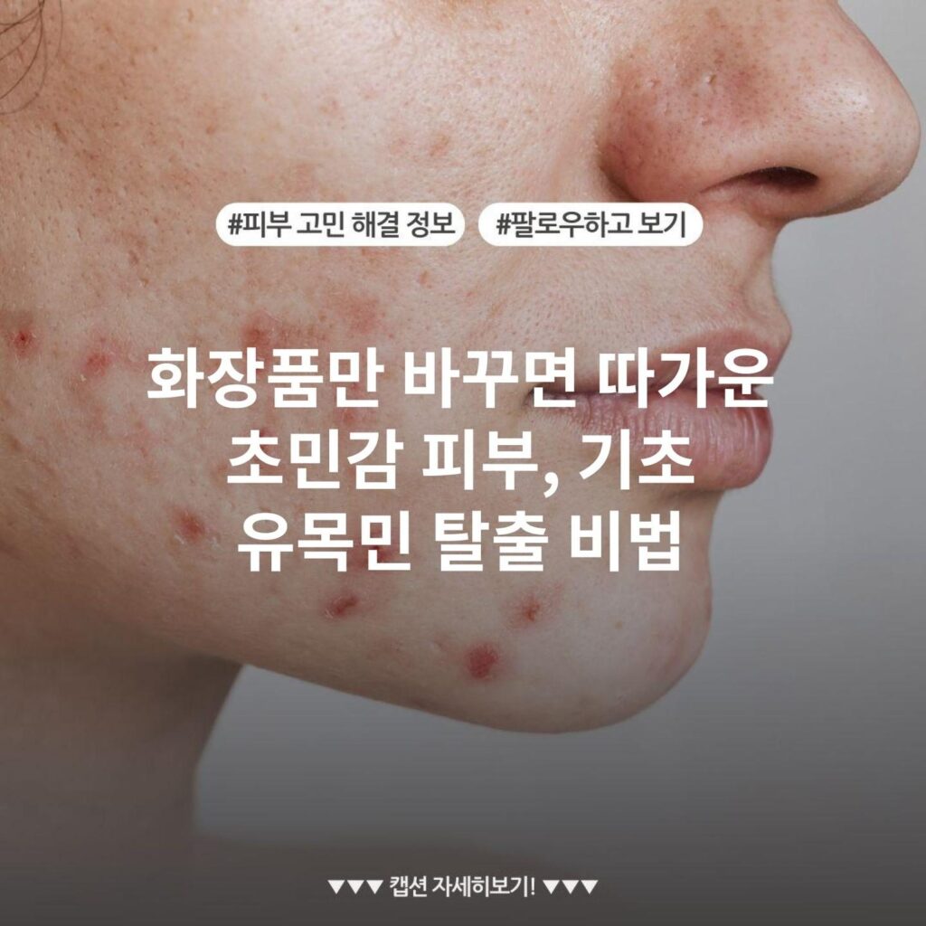 화장품만 바꾸면 따가운 초민감 피부, 기초 유목민 탈출 비법