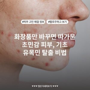 화장품만 바꾸면 따가운 초민감 피부, 기초 유목민 탈출 비법