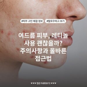 여드름 피부, 레티놀 사용 괜찮을까? 주의사항과 올바른 접근법