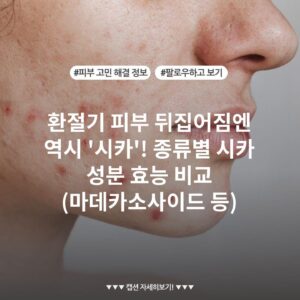 환절기 피부 뒤집어짐엔 역시 '시카'! 종류별 시카 성분 효능 비교 (마데카소사이드 등)