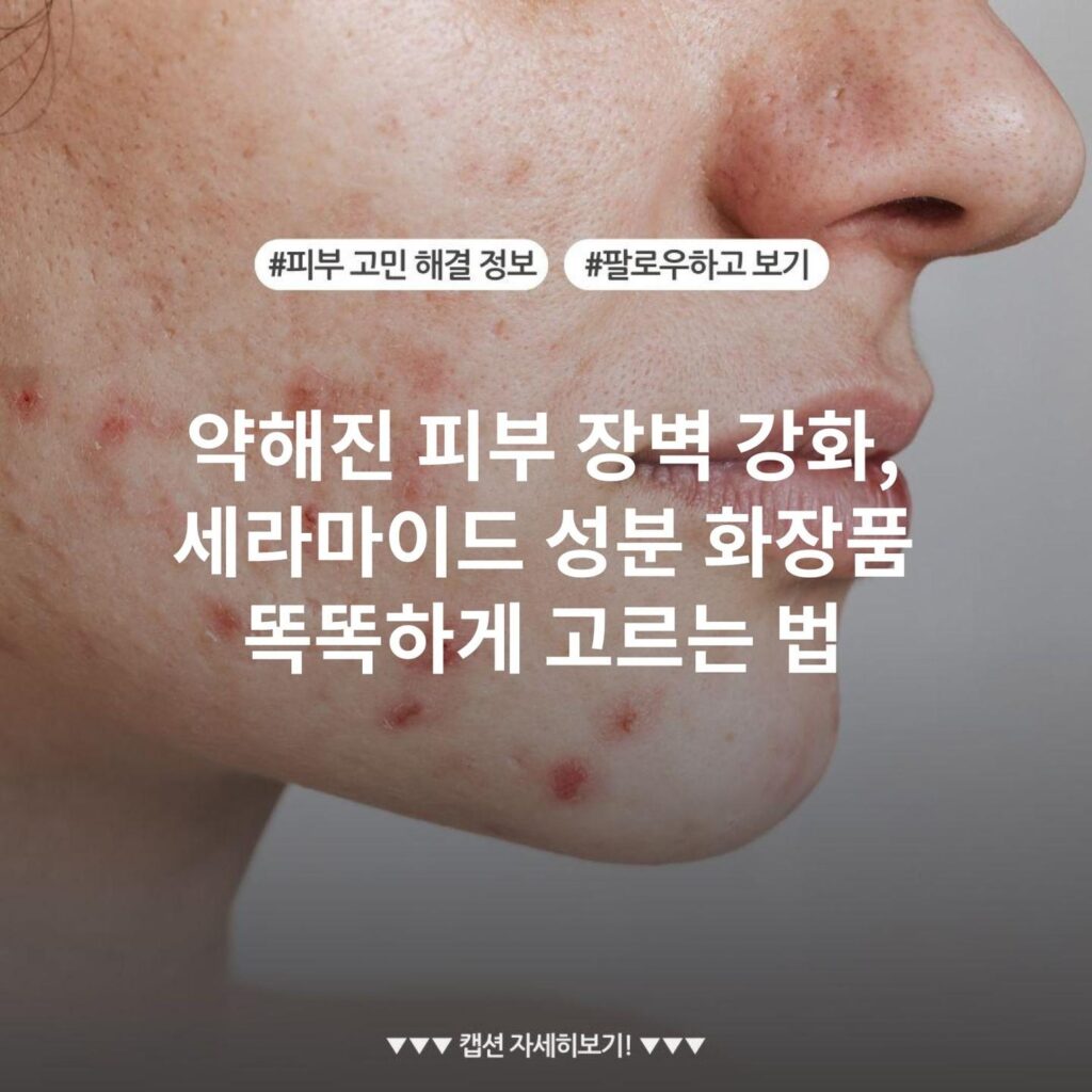 약해진 피부 장벽 강화, 세라마이드 성분 화장품 똑똑하게 고르는 법
