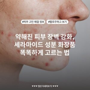 약해진 피부 장벽 강화, 세라마이드 성분 화장품 똑똑하게 고르는 법