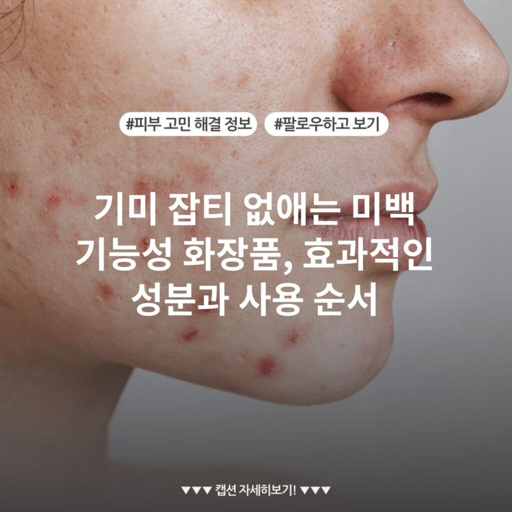 기미 잡티 없애는 미백 기능성 화장품, 효과적인 성분과 사용 순서