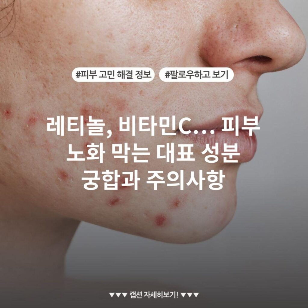 레티놀, 비타민C… 피부 노화 막는 대표 성분 궁합과 주의사항
