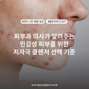 피부과 의사가 알려주는 민감성 피부를 위한 저자극 클렌저 선택 기준