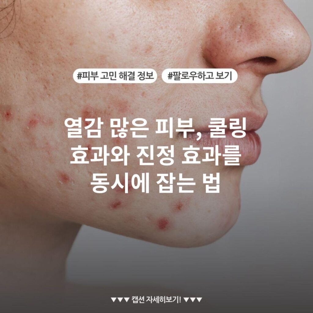 열감 많은 피부, 쿨링 효과와 진정 효과를 동시에 잡는 법