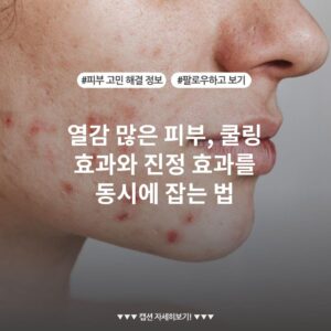 열감 많은 피부, 쿨링 효과와 진정 효과를 동시에 잡는 법
