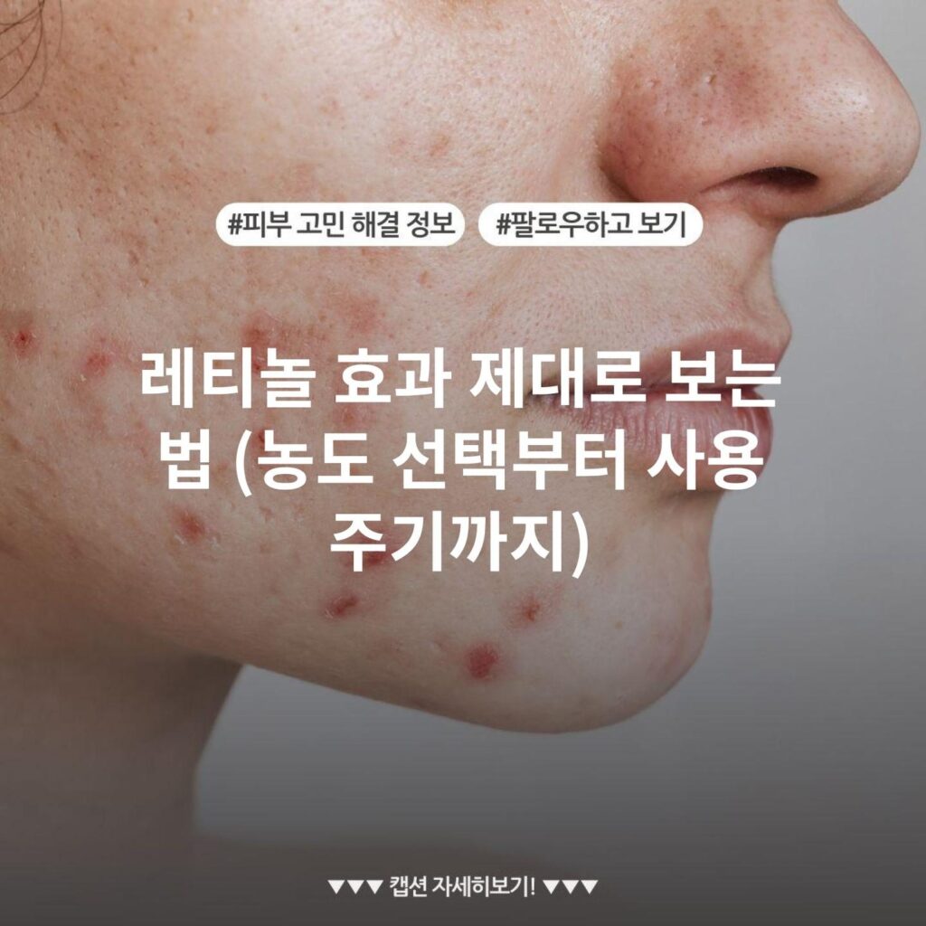 레티놀 효과 제대로 보는 법 (농도 선택부터 사용 주기까지)