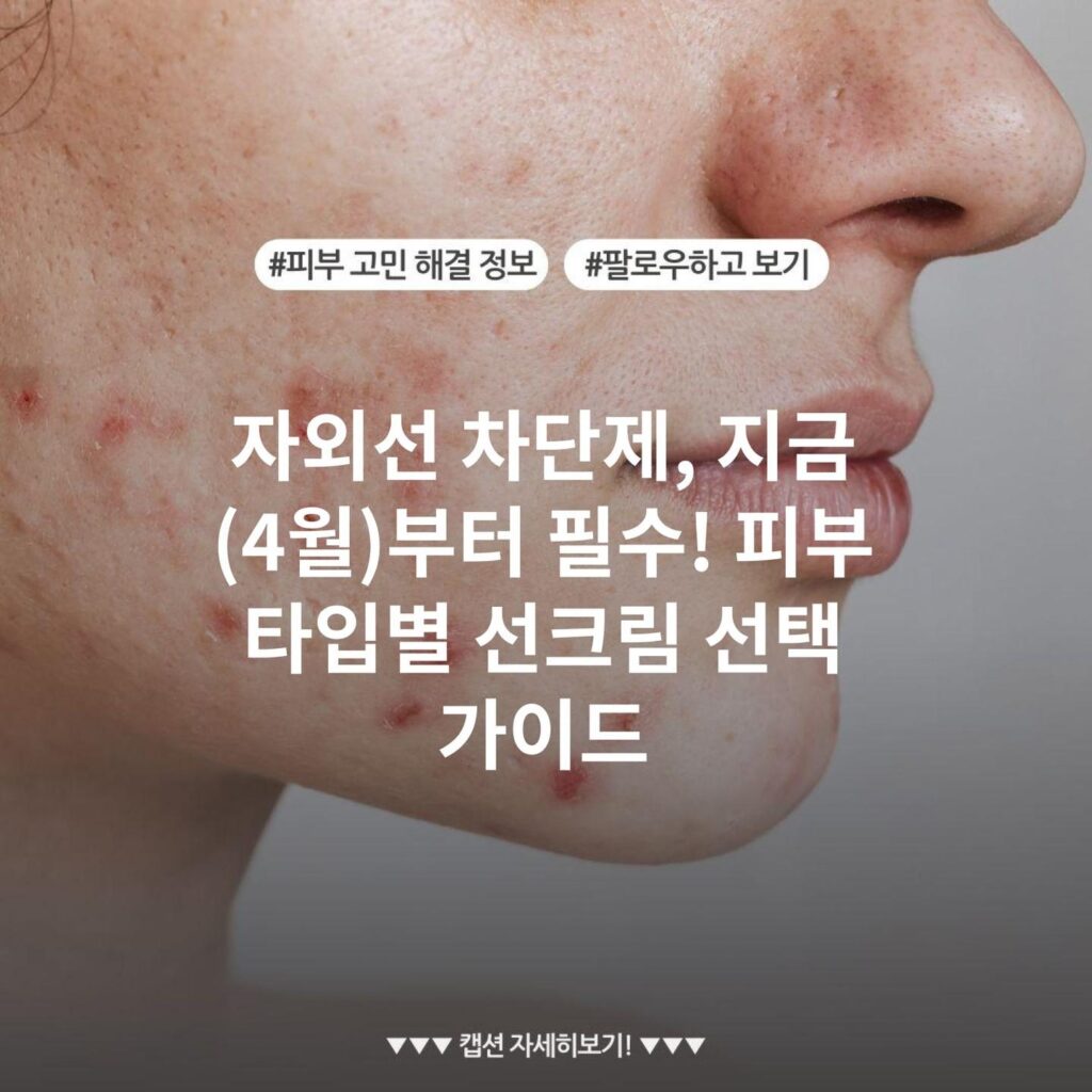 자외선 차단제, 지금(4월)부터 필수! 피부 타입별 선크림 선택 가이드