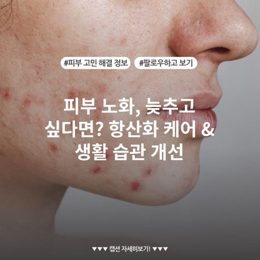 피부 노화, 늦추고 싶다면? 항산화 케어 & 생활 습관 개선 - STYLE.CHEC