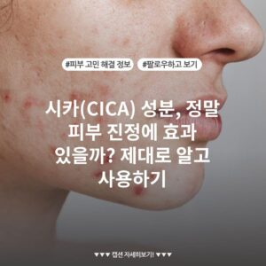 시카(CICA) 성분, 정말 피부 진정에 효과 있을까? 제대로 알고 사용하기