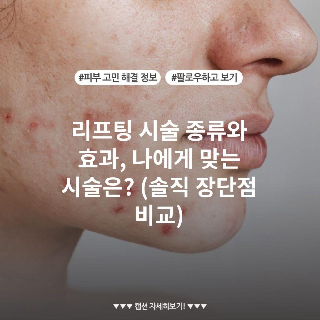 리프팅 시술 종류와 효과, 나에게 맞는 시술은? (솔직 장단점 비교)